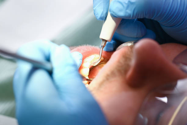 Best Orthodontic Emergency Dentist in Stockton, UT