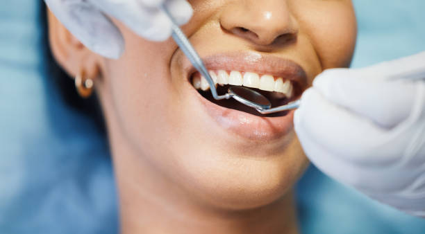 Best Emergency Dental Extractions in Stockton, UT